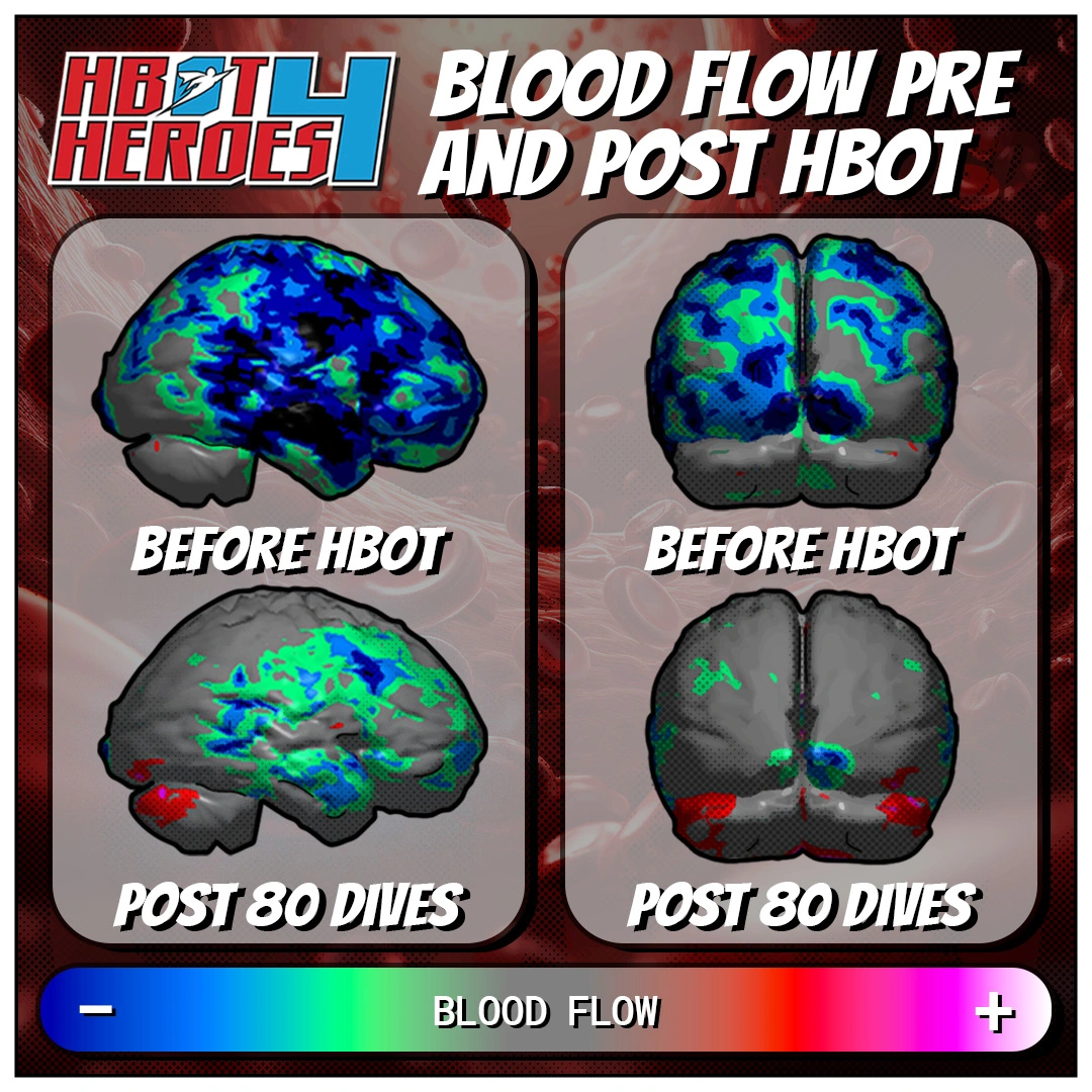 Blood Flow Scans